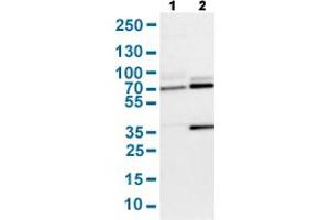 Western Blot analysis with SENP1 polyclonal antibody . (SENP1 Antikörper  (AA 85-204))