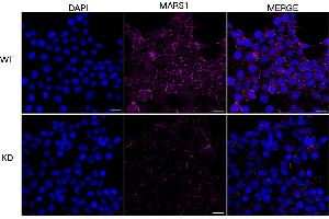 anti-Methionine--tRNA Ligase, Cytoplasmic antibody