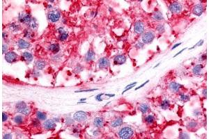 Immunohistochemistry (IHC) image for anti-Nuclear Receptor Subfamily 5, Group A, Member 2 (NR5A2) (C-Term) antibody (ABIN1049146)