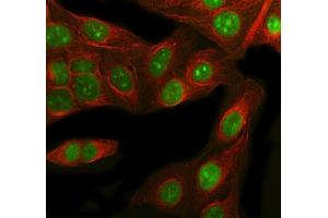 IF analysis of RbAp48 using anti-RbAp48 antibody (ABIN3043920) and anti-Beta Tubulin antibody (ABIN7602743). (Retinoblastoma Binding Protein 4 Antikörper  (C-Term))