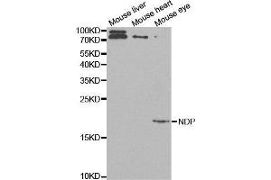 Western blot analysis of extracts of various cell lines, using NDP antibody. (Norrie Disease (Pseudoglioma) Antikörper  (AA 25-133))