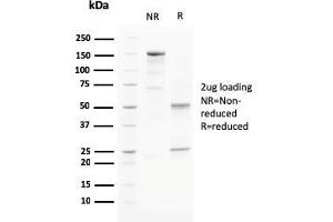 SDS-PAGE Analysis Purified PAPP-A Mouse Monoclonal Antibody (PAPPA/2715). (PAPPA Antikörper  (AA 351-523))