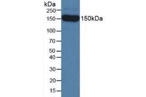 Detection of SEMA5B in Mouse Serum using Polyclonal Antibody to Semaphorin 5B (SEMA5B) (SEMA5B Antikörper  (AA 836-1013))