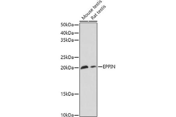 Eppin Antikörper  (AA 22-133)
