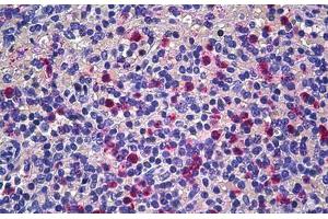 Human Spleen: Formalin-Fixed, Paraffin-Embedded (FFPE) (CD177 Antikörper  (AA 21-120))