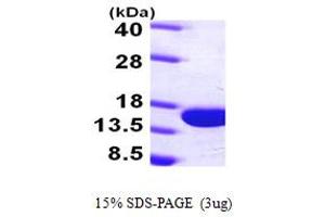 SDS-PAGE (SDS) image for Parvalbumin (PVALB) (AA 1-110) protein (His tag) (ABIN667261)