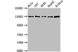 Western Blot Positive WB detected in: Hela whole cell lysate, U87 whole cell lysate, A549 whole cell lysate, HepG2 whole cell lysate, Mouse kidney tissue All lanes: SLC12A2 antibody at 6. (SLC12A2 Antikörper  (AA 110-282))