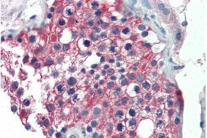 ABIN185587 (5µg/ml) staining of paraffin embedded Human Testis. (ALDH1A1 Antikörper  (Internal Region))