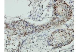 Image no. 1 for anti-RNA Guanine-7 Methyltransferase (RNMT) (AA 1-477) antibody (ABIN599057) (RNMT Antikörper  (AA 1-477))
