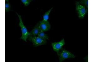 Anti-CLPP mouse monoclonal antibody (ABIN2452910) immunofluorescent staining of COS7 cells transiently transfected by pCMV6-ENTRY CLPP (RC200301). (CLPP Antikörper)