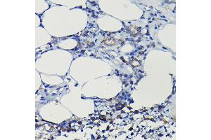 Immunohistochemistry of paraffin-embedded rat lung using iNOS Rabbit pAb  at dilution of 1:100 (40x lens). (NOS2 Antikörper  (AA 500-730))