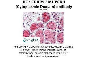 Image no. 2 for anti-Mucin and Cadherin-Like (CDHR5) (Cytoplasmic Domain) antibody (ABIN1732922) (CDHR5 Antikörper  (Cytoplasmic Domain))