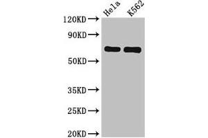 Western Blot Positive WB detected in: Hela whole cell lysate, K562 whole cell lysate All lanes: SNX9 antibody at 6. (SNX9 Antikörper  (AA 85-200))