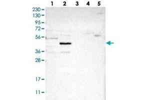 Western blot analysis of Lane 1: RT-4, Lane 2: U-251 MG, Lane 3: Human Plasma, Lane 4: Liver, Lane 5: Tonsil with NSUN5 polyclonal antibody  at 1:250-1:500 dilution. (NSUN5 Antikörper)