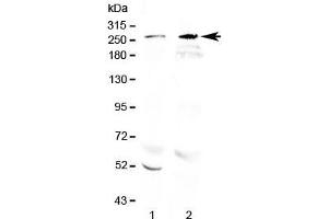 Western blot testing of 1) rat brain and 2) mouse brain lysate with RanBP2 antibody at 0. (RANBP2 Antikörper  (AA 3018-3057))