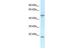 Image no. 1 for anti-Zinc Finger Protein 113 (ZFP113) (AA 200-249) antibody (ABIN6747579) (Zfp113 Antikörper  (AA 200-249))