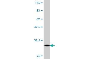 Western Blot detection against Immunogen (30. (FPR2 Antikörper  (AA 163-205))