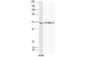 A549 lysate probed with Rabbit Anti-Perilipin 2 Polyclonal Antibody, Unconjugated  at 1:5000 for 90min at 37˚C. (ADRP Antikörper  (AA 341-437))
