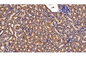 Detection of MGEA5 in Mouse Kidney Tissue using Polyclonal Antibody to Meningioma Expressed Antigen 5 (MGEA5) (MGEA5 Antikörper  (AA 319-450))