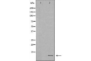 Western blot analysis of extracts of MB435, using HAMP antibody. (Hepcidin Antikörper  (Internal Region))