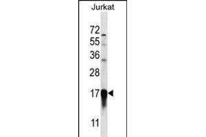 PFDN5 Antibody (Center) (ABIN657046 and ABIN2846213) western blot analysis in Jurkat cell line lysates (35 μg/lane).