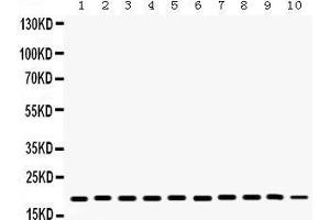 Western Blotting (WB) image for anti-Cofilin 1 (CFL1) (AA 122-152), (C-Term) antibody (ABIN3042746) (Cofilin Antikörper  (C-Term))