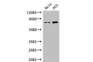 Western Blot Positive WB detected in: Hela whole cell lysate, PC-3 whole cell lysate All lanes: STRBP antibody at 2. (STRBP Antikörper  (AA 201-500))