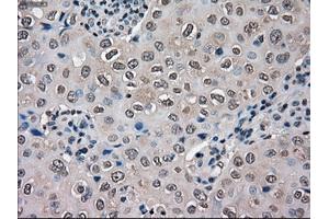 Immunohistochemical staining of paraffin-embedded Ovary tissue using anti-SLC18A2 mouse monoclonal antibody. (SLC18A2 Antikörper)