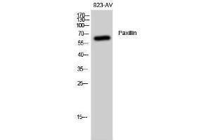 Western Blotting (WB) image for anti-Paxillin (PXN) (Thr508) antibody (ABIN3186344) (Paxillin Antikörper  (Thr508))