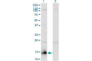 Western Blot analysis of CHURC1 expression in transfected 293T cell line by CHURC1 monoclonal antibody (M01), clone 2F9. (CHURC1 Antikörper  (AA 1-112))