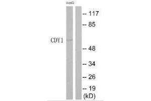 Western blot analysis of extracts from HepG2 cells, using CDY1 antibody. (CDY1 Antikörper)
