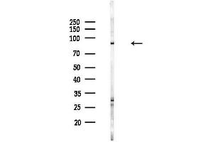 anti-Tectonic Family Member 2 (TCTN2) (Internal Region) antibody