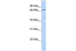 WB Suggested Anti-KLHL15 Antibody Titration: 0. (KLHL15 Antikörper  (Middle Region))