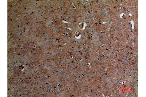 Immunohistochemistry (IHC) analysis of paraffin-embedded Mouse Brain, antibody was diluted at 1:100. (ALDOC Antikörper  (N-Term))