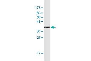 Western Blot detection against Immunogen (35. (Nephrin Antikörper  (AA 33-122))