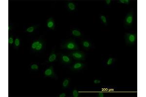 Immunofluorescence of monoclonal antibody to PLK1 on HeLa cell. (PLK1 Antikörper  (AA 1-603))
