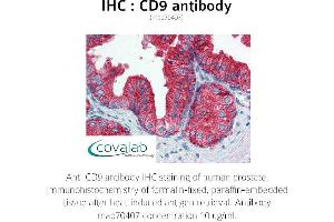 Image no. 1 for anti-CD9 (CD9) antibody (ABIN1723299) (CD9 Antikörper)