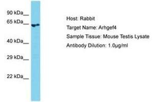 Image no. 1 for anti-rho Guanine Nucleotide Exchange Factor (GEF) 4 (ARHGEF4) (AA 51-100) antibody (ABIN6750412) (ARHGEF4 Antikörper  (AA 51-100))