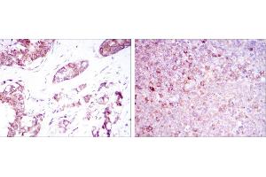 Immunohistochemistry (IHC) image for anti-Bone Morphogenetic Protein Receptor, Type II (serine/threonine Kinase) (BMPR2) antibody (ABIN968987)
