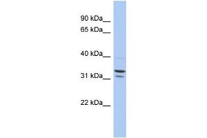 WB Suggested Anti-FAM92B Antibody Titration: 0. (FAM92B Antikörper  (N-Term))
