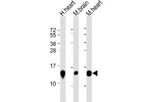 All lanes : Anti-NDUFB3 Antibody (N-Term) at 1:8000 dilution Lane 1: human heart lysate Lane 2: mouse brain lysate Lane 3: mouse heart lysate Lysates/proteins at 20 μg per lane. (NDUFB3 Antikörper  (AA 13-45))