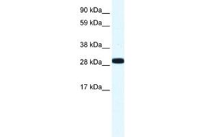 WB Suggested Anti-ANXA4 Antibody Titration:  1. (Annexin IV Antikörper  (N-Term))