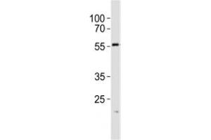 Western blot analysis of lysate from A431 cell line using SPHK1 antibody at 1:1000.