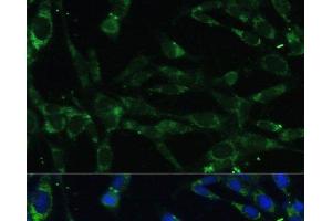 Immunofluorescence analysis of NIH-3T3 cells using CAPN5 Polyclonal Antibody at dilution of 1:100. (Calpain 5 Antikörper)