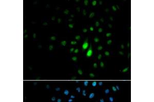 Immunofluorescence analysis of MCF-7 cells using PIN1 Polyclonal Antibody (PIN1 Antikörper)