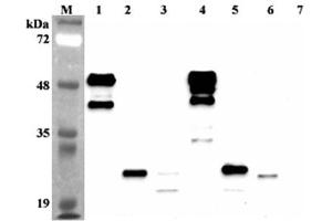 Western blot analysis using anti-FGF-21 (human), mAb (FG224-7)  at 1:2'000 dilution.