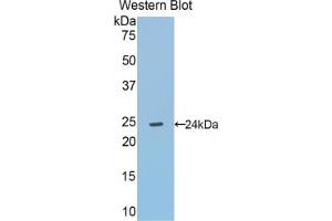 Western blot analysis of the recombinant protein.