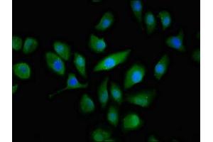 Immunofluorescent analysis of A549 cells using ABIN7146640 at dilution of 1:100 and Alexa Fluor 488-congugated AffiniPure Goat Anti-Rabbit IgG(H+L) (ABCC3 Antikörper  (AA 827-953))