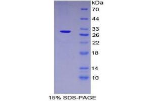 SDS-PAGE analysis of Mouse Tubulin beta 6 Protein. (TUBb6 Protein)