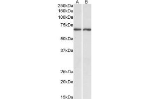 Acetylcholinesterase Antikörper  (C-Term)